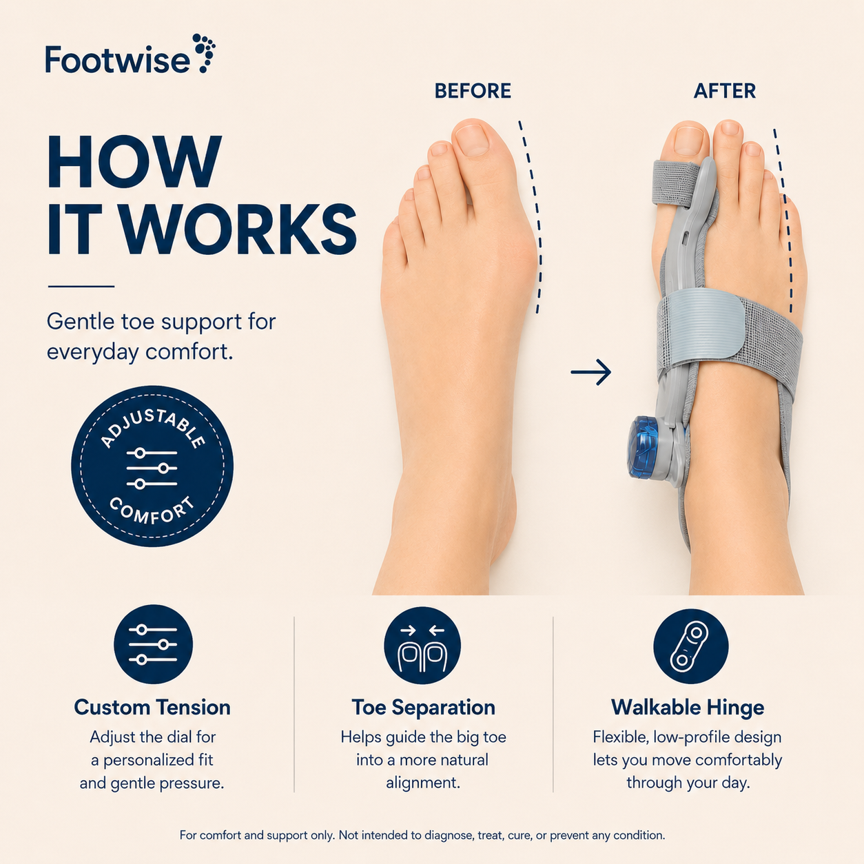 Adjustable Bunion Corrector
